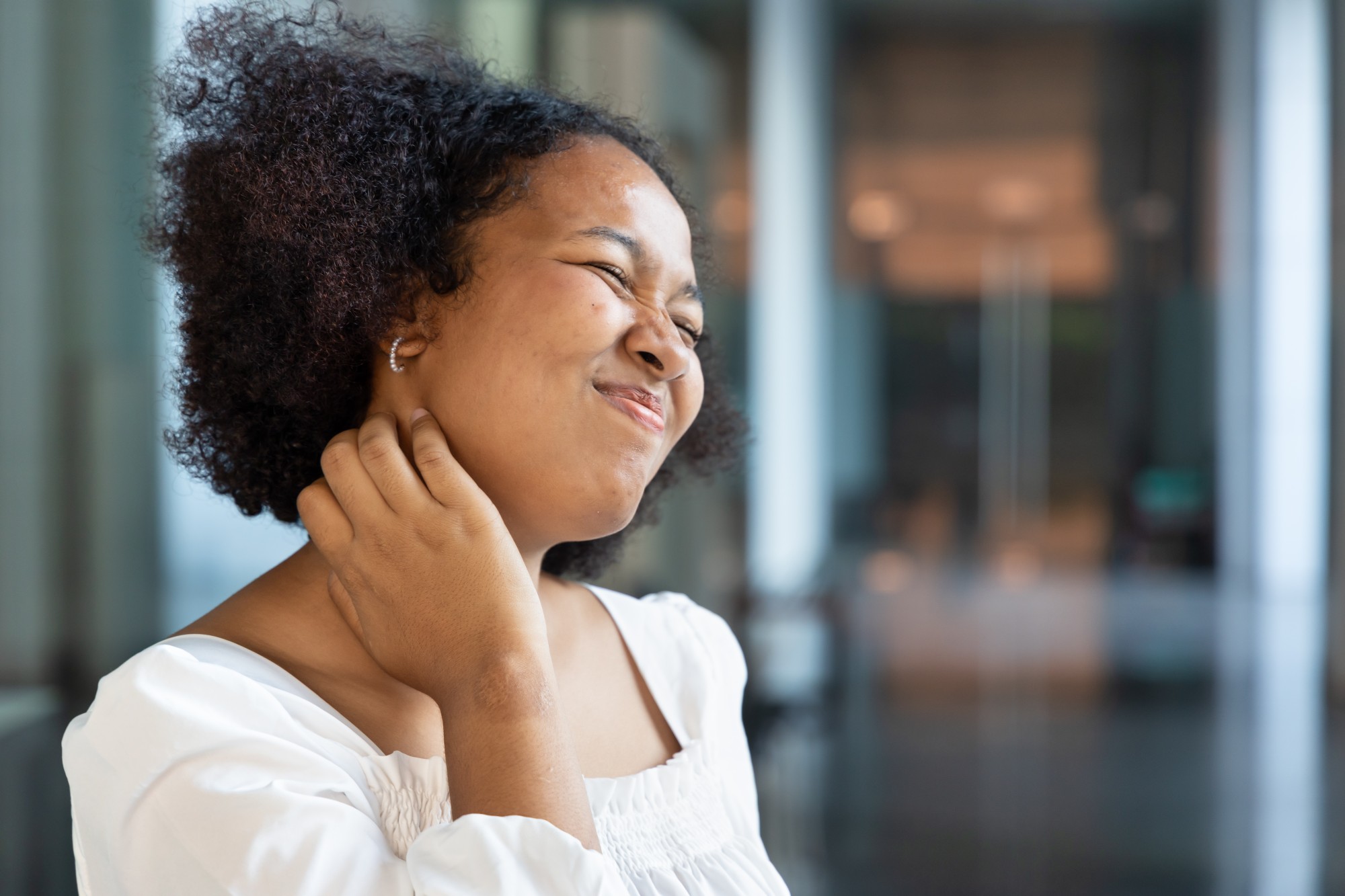 Photo of young woman with atopic dermatitis